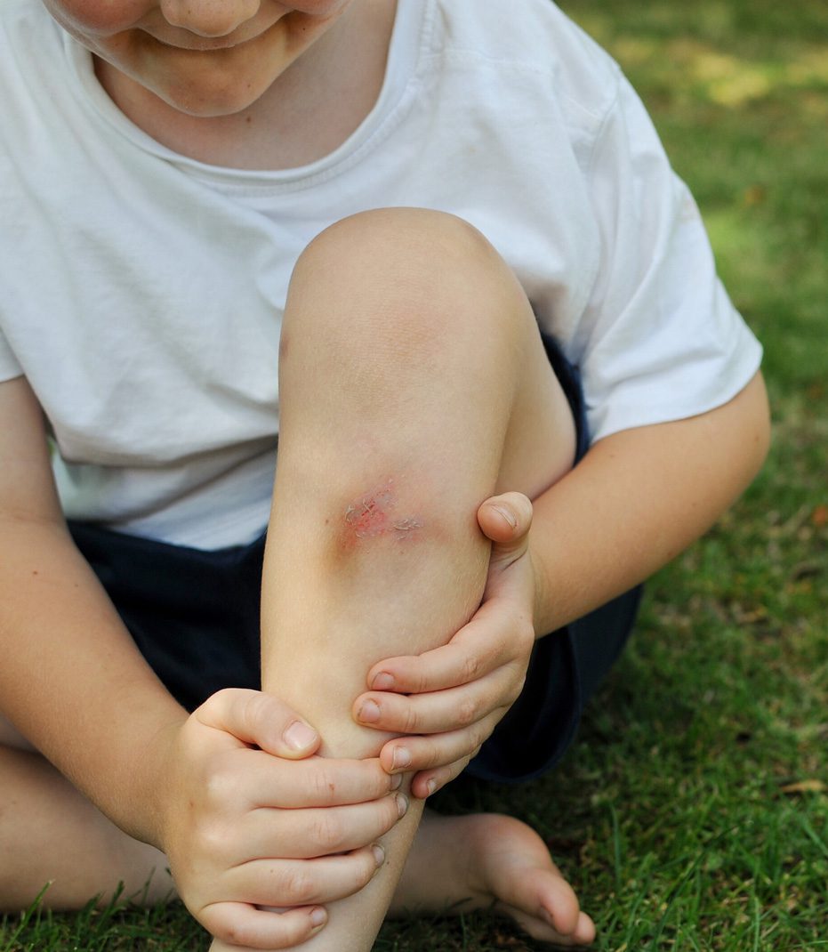 Child-injury-in-premises-liability-case